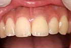 治療後5