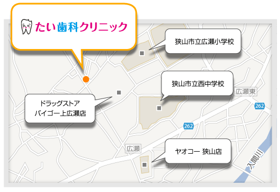 地図イラスト